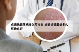 点滴状银屑病多久可治愈 点滴状银屑病多久可治愈好