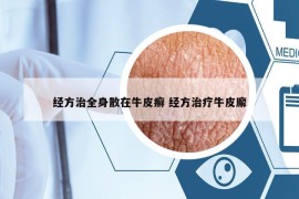 经方治全身散在牛皮癣 经方治疗牛皮廨