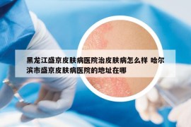 黑龙江盛京皮肤病医院治皮肤病怎么样 哈尔滨市盛京皮肤病医院的地址在哪