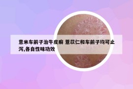 意米车前子治牛皮癣 薏苡仁和车前子均可止泻,各自性味功效