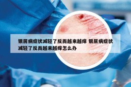 银屑病症状减轻了反而越来越痒 银屑病症状减轻了反而越来越痒怎么办