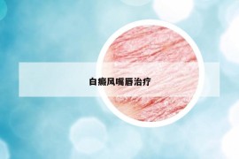 白癜风嘴唇治疗