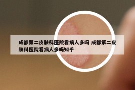 成都第二皮肤科医院看病人多吗 成都第二皮肤科医院看病人多吗知乎