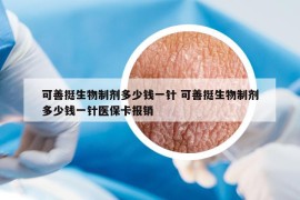 可善挺生物制剂多少钱一针 可善挺生物制剂多少钱一针医保卡报销