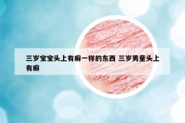 三岁宝宝头上有癣一样的东西 三岁男童头上有癣