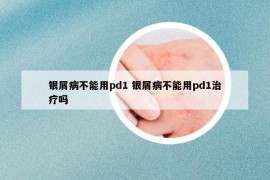 银屑病不能用pd1 银屑病不能用pd1治疗吗