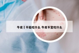 牛皮廯不能吃什么 牛皮不宜吃什么