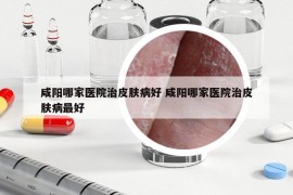 咸阳哪家医院治皮肤病好 咸阳哪家医院治皮肤病最好