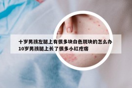 十岁男孩左腿上有很多块白色斑块的怎么办 10岁男孩腿上长了很多小红疙瘩