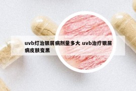 uvb灯治银屑病剂量多大 uvb治疗银屑病皮肤变黑