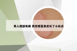 男人根部有癣 男性根茎表皮长了小白点