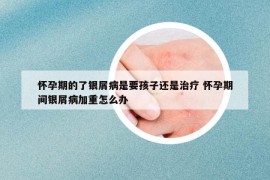 怀孕期的了银屑病是要孩子还是治疗 怀孕期间银屑病加重怎么办