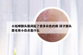 小姑娘额头眉间起了很多白色的癣 孩子额头眉毛有小白点是什么