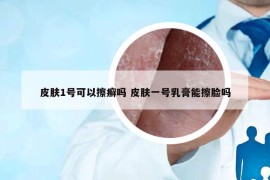 皮肤1号可以擦癣吗 皮肤一号乳膏能擦脸吗