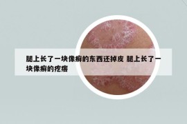 腿上长了一块像癣的东西还掉皮 腿上长了一块像癣的疙瘩