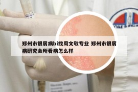 郑州市银屑病bi找周文敬专业 郑州市银屑病研究会所看病怎么样