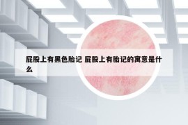 屁股上有黑色胎记 屁股上有胎记的寓意是什么