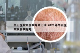 华山医院银屑病专家门诊 2021年华山医院银屑病贴吧