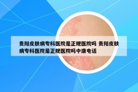 贵阳皮肤病专科医院是正规医院吗 贵阳皮肤病专科医院是正规医院吗中康电话