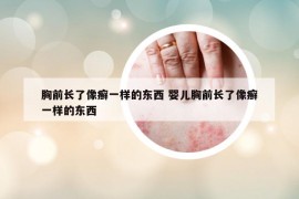 胸前长了像癣一样的东西 婴儿胸前长了像癣一样的东西