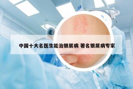 中国十大名医生能治银屑病 著名银屑病专家