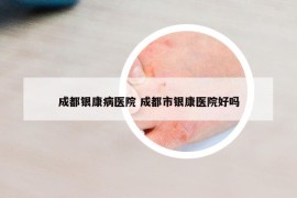 成都银康病医院 成都市银康医院好吗