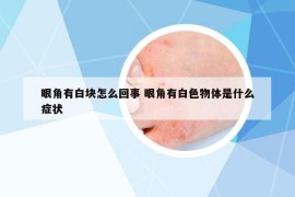 眼角有白块怎么回事 眼角有白色物体是什么症状