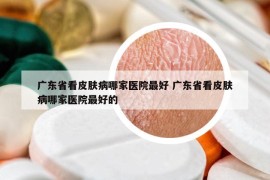 广东省看皮肤病哪家医院最好 广东省看皮肤病哪家医院最好的