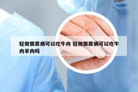 轻微银屑病可以吃牛肉 轻微银屑病可以吃牛肉羊肉吗