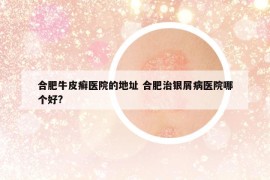 合肥牛皮癣医院的地址 合肥治银屑病医院哪个好?