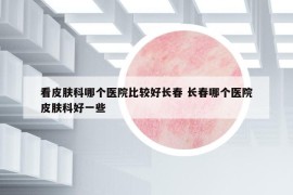 看皮肤科哪个医院比较好长春 长春哪个医院皮肤科好一些