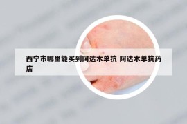 西宁市哪里能买到阿达木单抗 阿达木单抗药店