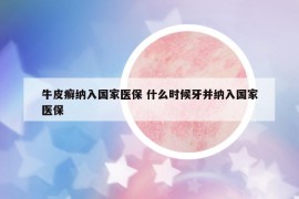 牛皮癣纳入国家医保 什么时候牙并纳入国家医保