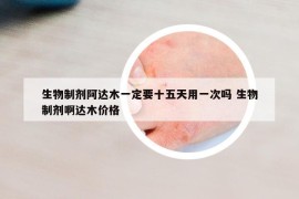 生物制剂阿达木一定要十五天用一次吗 生物制剂啊达木价格