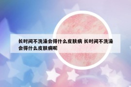 长时间不洗澡会得什么皮肤病 长时间不洗澡会得什么皮肤病呢