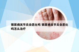 银屑病关节炎会恶化吗 银屑病关节炎会恶化吗怎么治疗