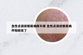 急性点滴状银屑病痒不痒 急性点滴状银屑病开始蜕皮了