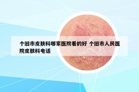 个旧市皮肤科哪家医院看的好 个旧市人民医院皮肤科电话