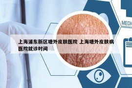 上海浦东新区塘外皮肤医院 上海塘外皮肤病医院就诊时间