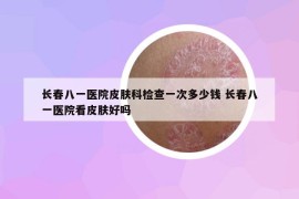 长春八一医院皮肤科检查一次多少钱 长春八一医院看皮肤好吗