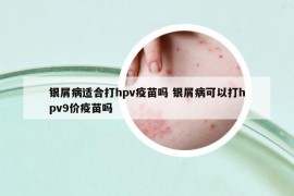 银屑病适合打hpv疫苗吗 银屑病可以打hpv9价疫苗吗