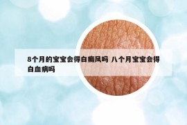 8个月的宝宝会得白癜风吗 八个月宝宝会得白血病吗