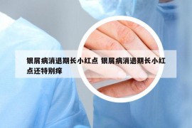 银屑病消退期长小红点 银屑病消退期长小红点还特别痒