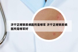 济宁正规银屑病医院是哪家 济宁正规银屑病医院是哪家好