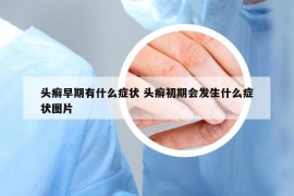 头癣早期有什么症状 头癣初期会发生什么症状图片