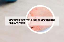 公安局牛皮癣管控的工作职责 公安局基础管控中心工作职责