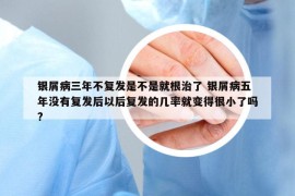 银屑病三年不复发是不是就根治了 银屑病五年没有复发后以后复发的几率就变得很小了吗?