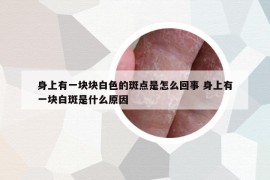 身上有一块块白色的斑点是怎么回事 身上有一块白斑是什么原因