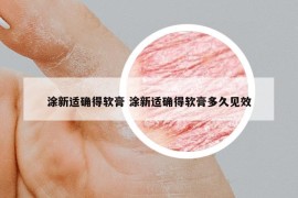 涂新适确得软膏 涂新适确得软膏多久见效