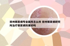 郑州银屑病专业医院怎么样 郑州银屑病研究所治疗银屑病效果好吗